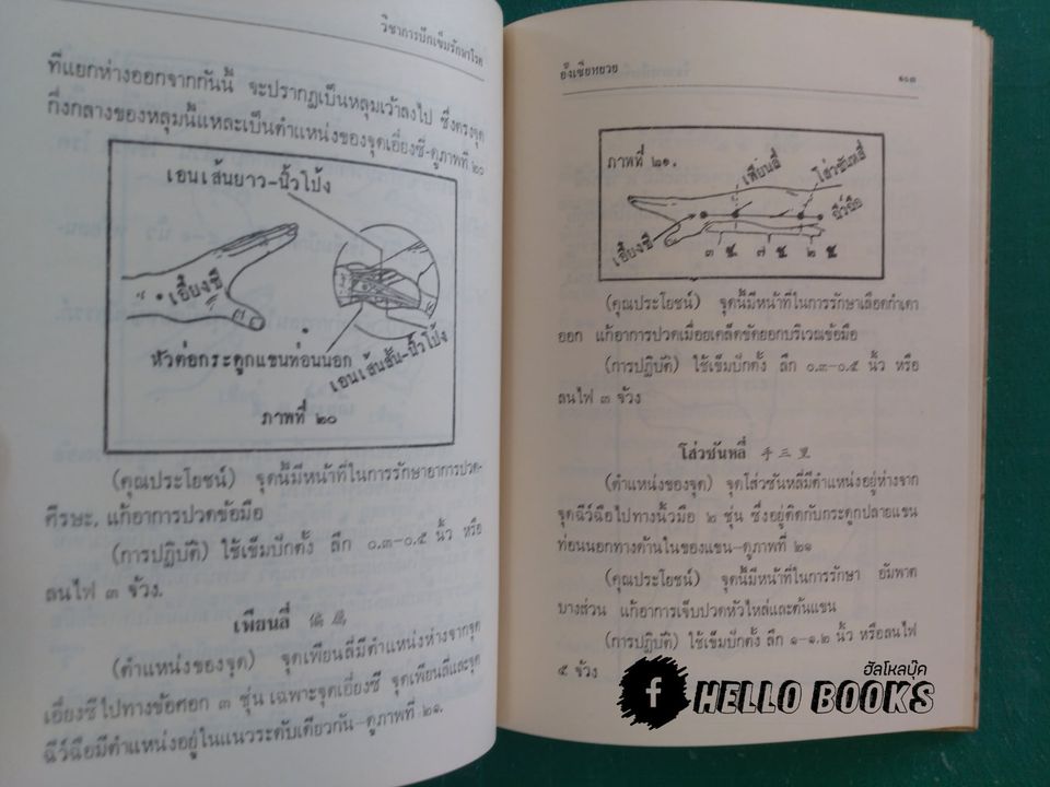 วิชาการปักเข็มรักษาโรค ภาคปฏิบัติเบื้องต้น