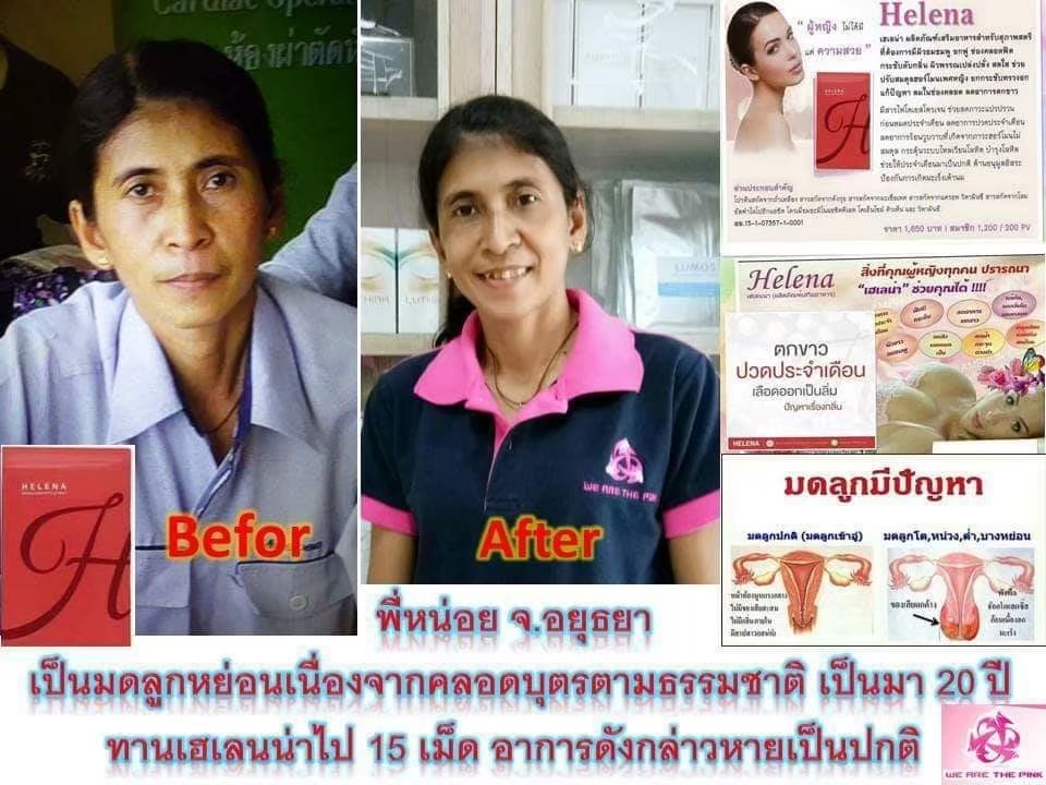 HELENA เพิ่มความมั่นใจไร้กลิ่นไม่พึงประสงค์ กระชับจุดซ่อนเร้น ตกขาว เรื่องภายในผู้หญิง ให้ Helena ดูแลคุณผู้หญิงให้ ฟิต ตึง กระชับ เติมเสน่ห์ให้คุณผู้หญิง