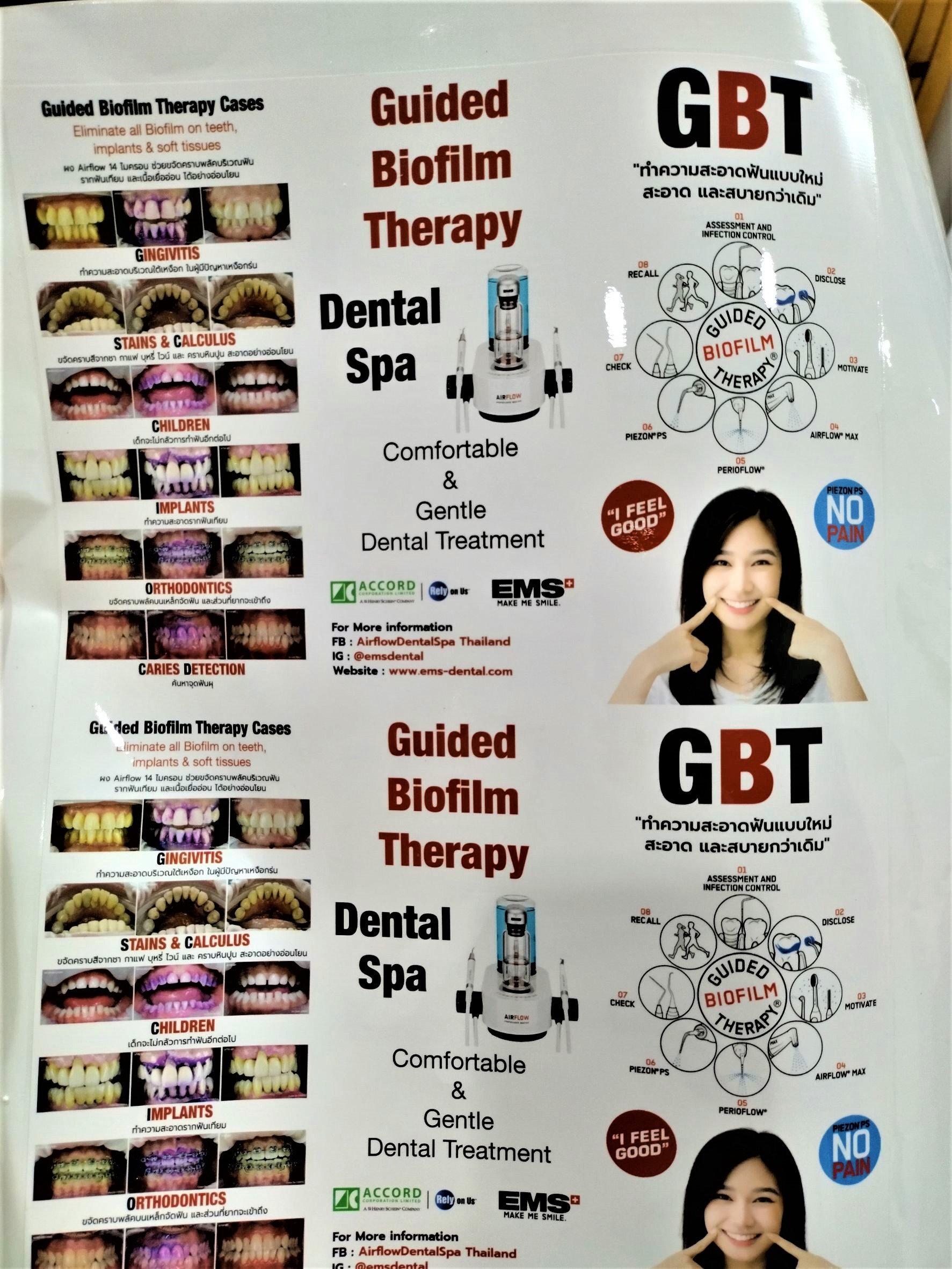 ฟิล์มเคลือบรูป ฟิล์มเงา ฟิล์มเคลือบเย็น แบบเงา กว้าง25นิ้วยาว 28เมตร 200ไมครอน