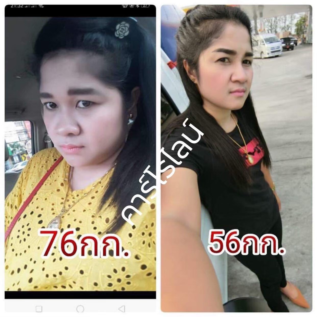 Caroline ลดน้ำหนัก ลดความอ้วน แบบลดเร็ว แต่สุขภาพดี ด้วย Caroline (คาโรไลน์) อาหารเสริมลดน้ำหนักสูตรคุณภาพ