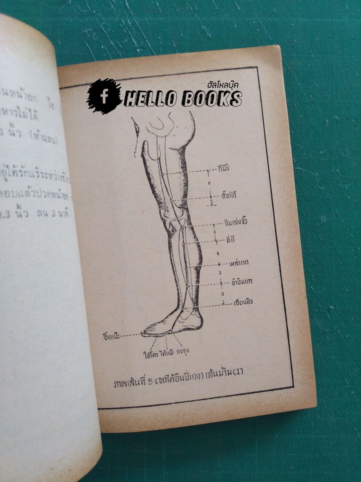 หมอเข็ม