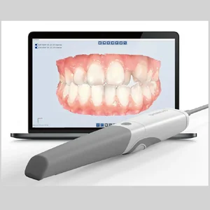Intraoral Scanner